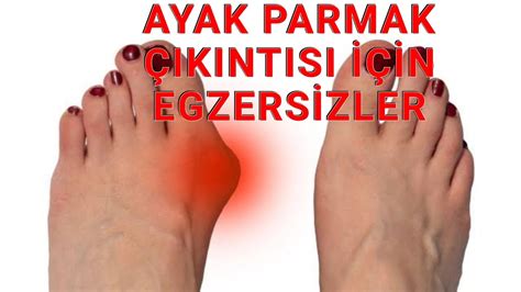 ayak halk yöntemleri ile artroz tedavisi